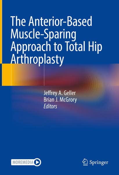 The Anterior-Based Muscle-Sparing Approach to Total Hip Arthroplasty 2022