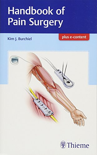 Handbook of Pain Surgery 2017