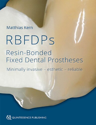 Resin-Bonded Fixed Dental Prostheses: Minimally invasive – esthetic – reliable 2019