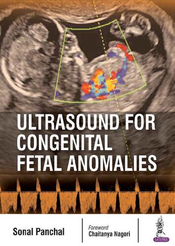 Ultrasound for Congenital Fetal Anomalies 2017