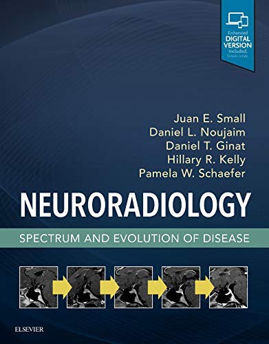 Neuroradiology: Spectrum and Evolution of Disease 2018