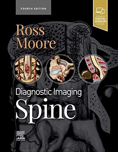 Diagnostic Imaging: Spine 2020