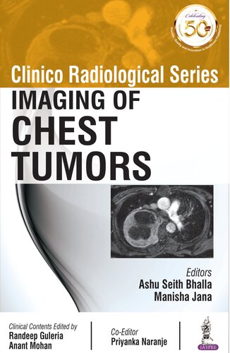 Clinico Radiological Series: Imaging of Chest Tumors 2019