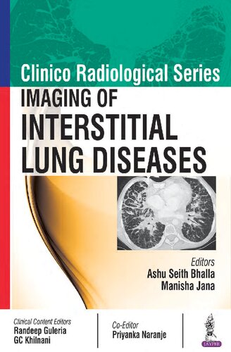 Clinico Radiological Series: Imaging of Interstitial Lung Diseases 2017
