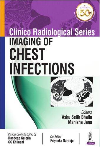 Clinico Radiological Series: Imaging of Chest Infections 2018