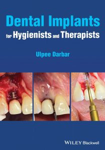 Dental Implants for Hygienists and Therapists 2022