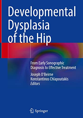 Developmental Dysplasia of the Hip: From Early Sonographic Diagnosis to Effective Treatment 2022