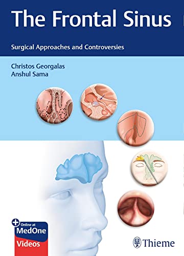 The Frontal Sinus: Surgical Approaches and Controversies 2022
