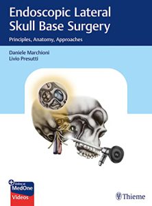 جراحی آندوسکوپی پایه جمجمه جانبی: اصول، آناتومی، رویکردها