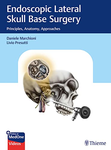 Endoscopic Lateral Skull Base Surgery: Principles, Anatomy, Approaches 2022