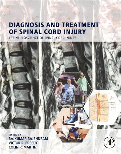 Diagnosis and Treatment of Spinal Cord Injury 2022