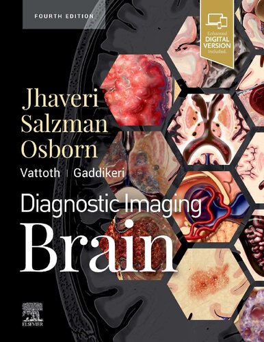 Diagnostic Imaging: Brain 2020