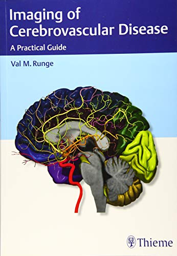 Imaging of Cerebrovascular Disease: A Practical Guide 2016