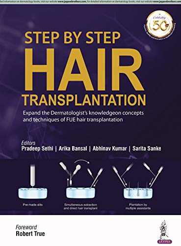 Step by Step Hair Transplantation 2019