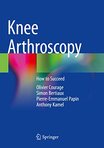 Knee Arthroscopy: How to Succeed 2022