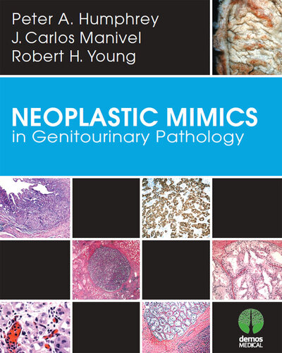 Neoplastic Mimics in Genitourinary Pathology 2013