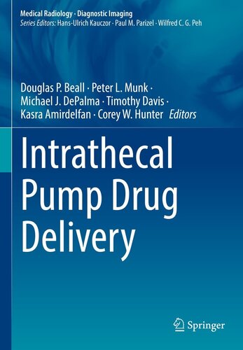 Intrathecal Pump Drug Delivery 2022
