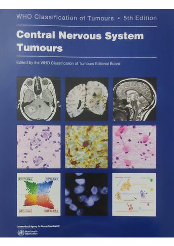 Central Nervous System Tumours 2022