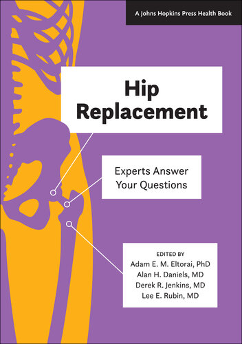 Hip Replacement: Experts Answer Your Questions 2019