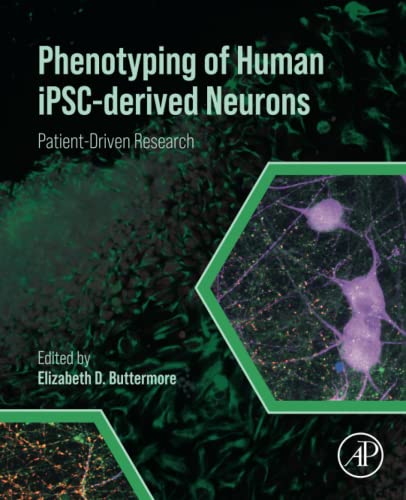 Phenotyping of Human IPSC-derived Neurons: Patient-Driven Research 2022