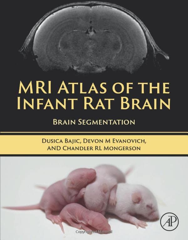 اطلس MRI مغز موش نوزاد: تقسیم بندی مغز