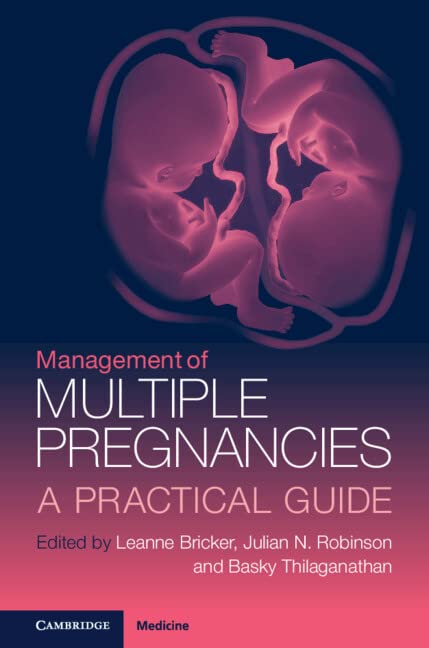 Management of Multiple Pregnancies: A Practical Guide 2022
