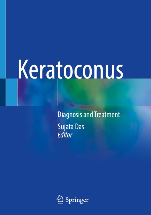 Keratoconus: Diagnosis and Treatment 2022