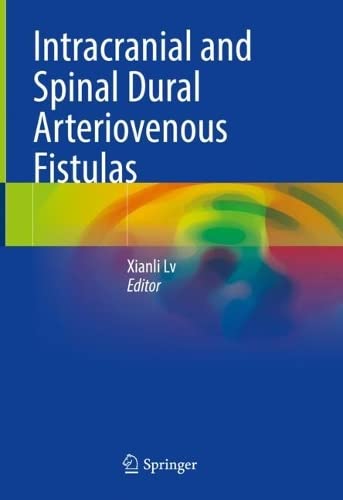 Intracranial and Spinal Dural Arteriovenous Fistulas 2022