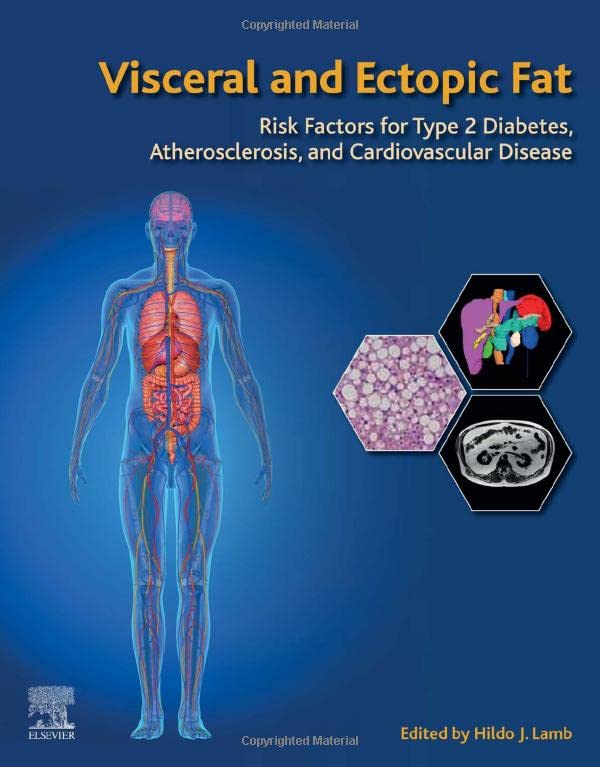 Visceral and Ectopic Fat: Risk Factors for Type 2 Diabetes, Atherosclerosis, and Cardiovascular Disease 2022