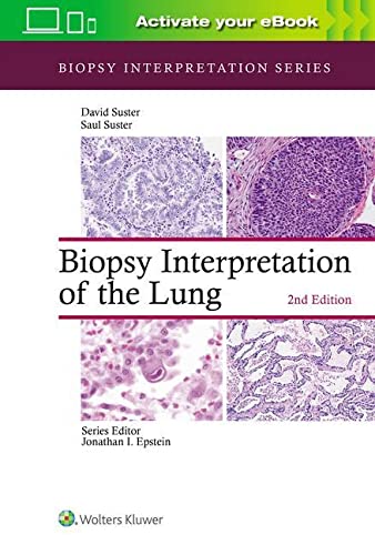 Biopsy Interpretation of the Lung 2020