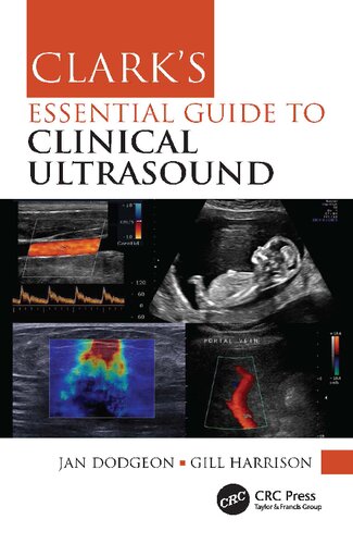 Clark's Essential Guide to Clinical Ultrasound 2023