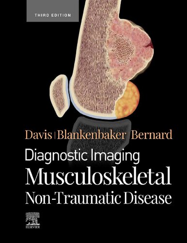 Diagnostic Imaging: Musculoskeletal Non-Traumatic Disease 2022