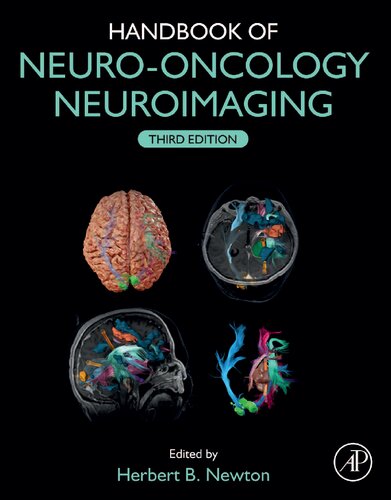 Handbook of Neuro-Oncology Neuroimaging 2022