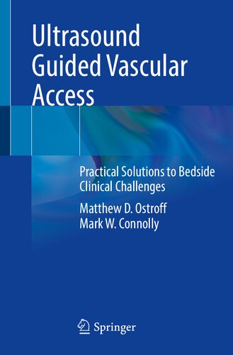 Ultrasound Guided Vascular Access: Practical Solutions to Bedside Clinical Challenges 2022