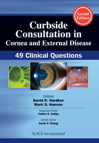 Curbside Consultation in Cornea and External Disease 2022