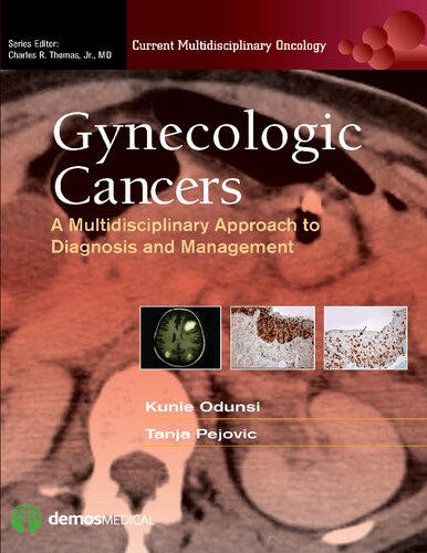 Gynecologic Cancers: A Multidisciplinary Approach to Diagnosis and Management 2013