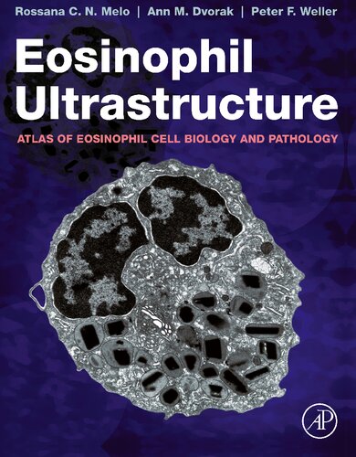 Eosinophil Ultrastructure: Atlas of Eosinophil Cell Biology and Pathology 2022