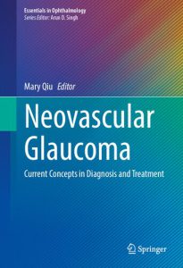 گلوکوم عصبی عروقی: مفاهیم رایج در تشخیص و درمان