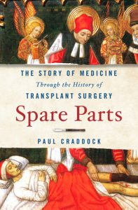 قطعات یدکی: داستان پزشکی از طریق تاریخچه جراحی پیوند