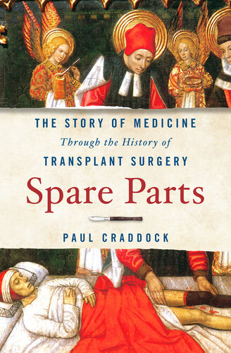 Spare Parts: The Story of Medicine Through the History of Transplant Surgery 2022