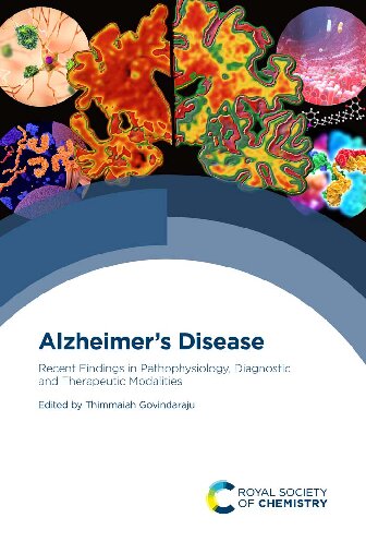Alzheimer's Disease 2022
