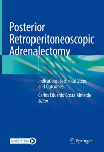 Posterior Retroperitoneoscopic Adrenalectomy: Indications, Technical Steps and Outcomes 2023