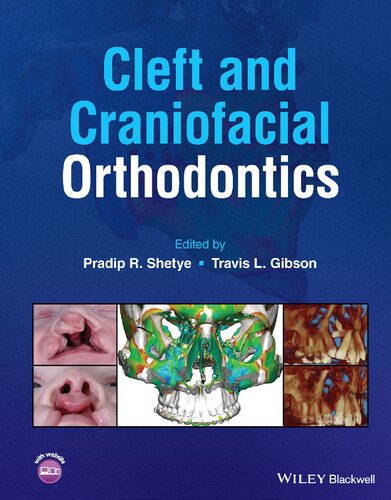 Cleft and Craniofacial Orthodontics 2023