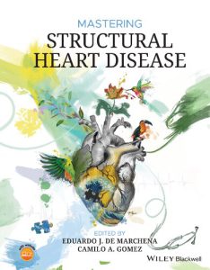 کنترل بیماری ساختاری قلب