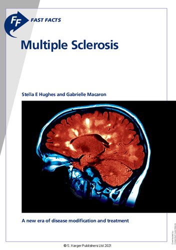 Fast Facts: Multiple Sclerosis: 5th edition. A new era of disease modification and treatment 2021