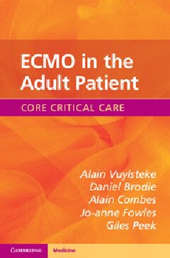 ECMO in the Adult Patient 2017