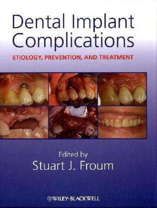 Dental Implant Complications: Etiology, Prevention, and Treatment 2010