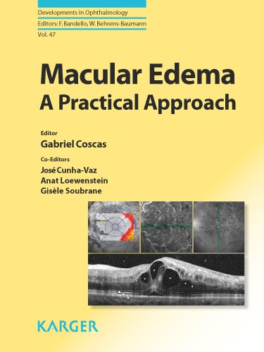 Macular Edema: A Practical Approach 2010