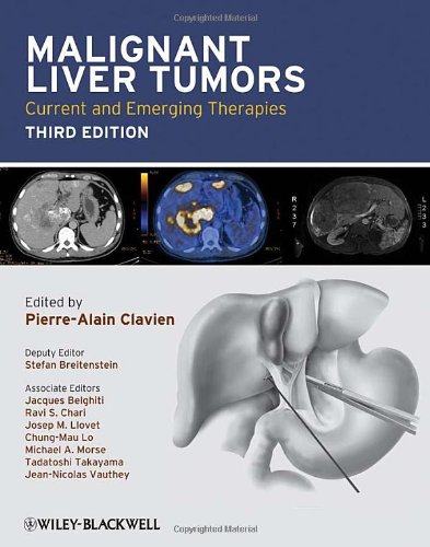 Malignant Liver Tumors: Current and Emerging Therapies 2010