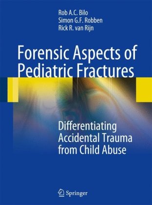 جنبه های پزشکی قانونی شکستگی های کودکان: تمایز بین ضربه تصادفی و کودک آزاری